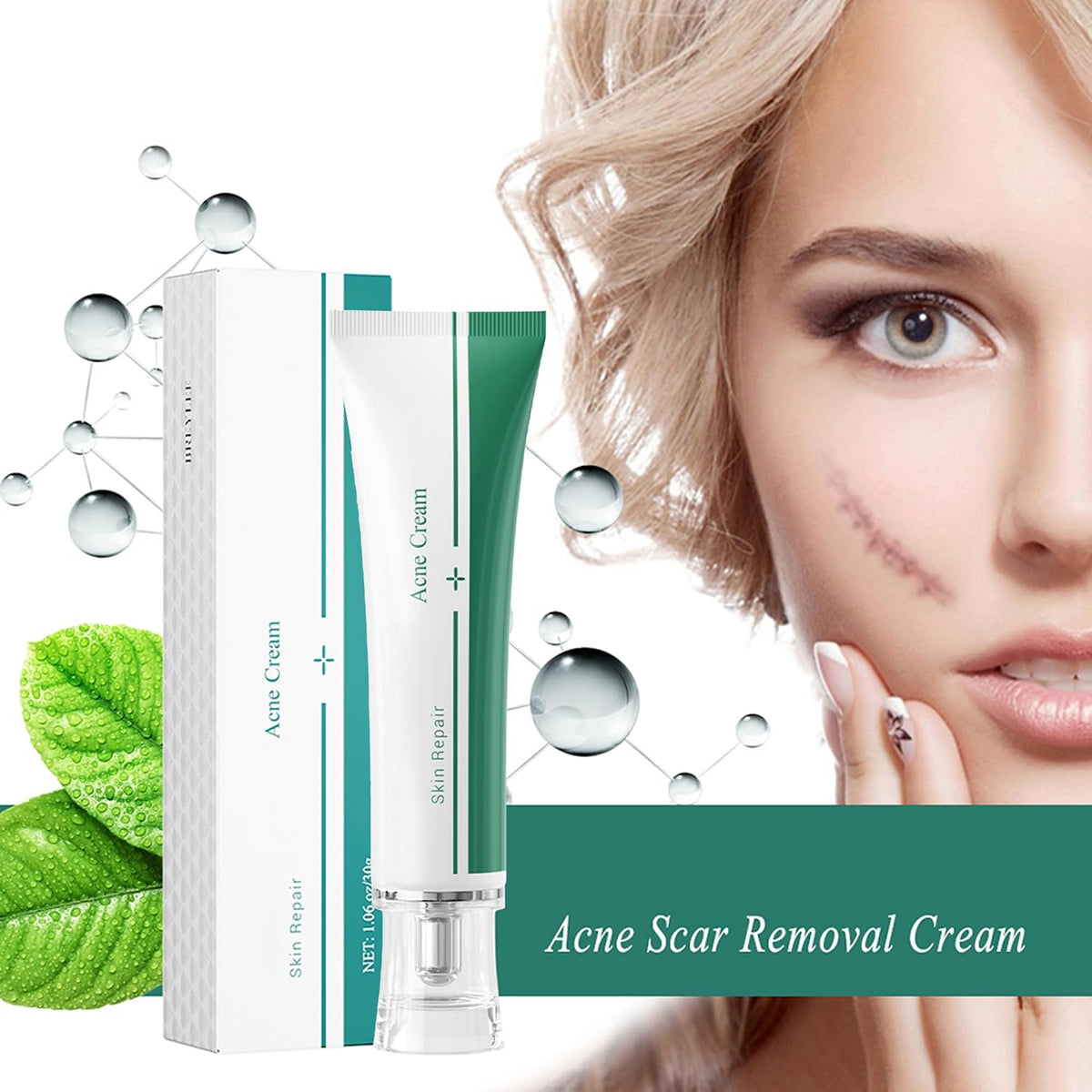 Scar Cream, Face Pimples Scar Stretch Marks Cream Moisturizing Repair Damaged Skin Gel Scar Treatment