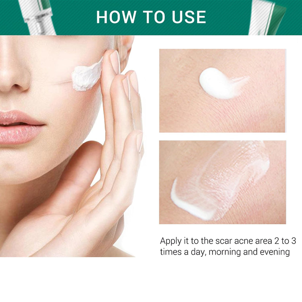 Scar Cream, Face Pimples Scar Stretch Marks Cream Moisturizing Repair Damaged Skin Gel Scar Treatment