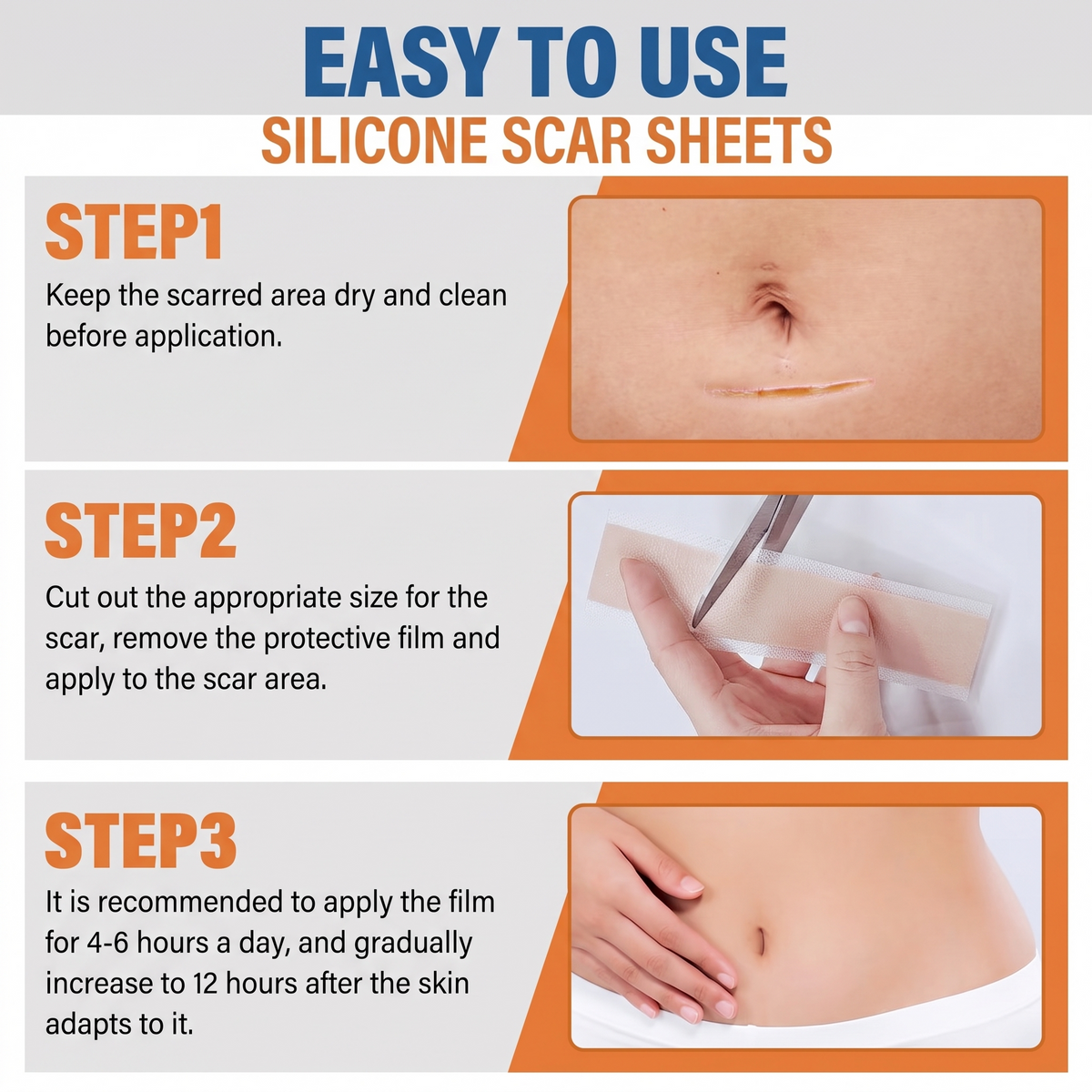 Silicone Scar Sheets, Medical Grade Silicone Scar Tape for Old & New Scars